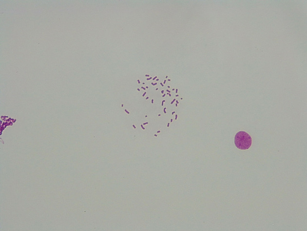 Male Chromosomes Slides - Male Chromosomes 08 400X